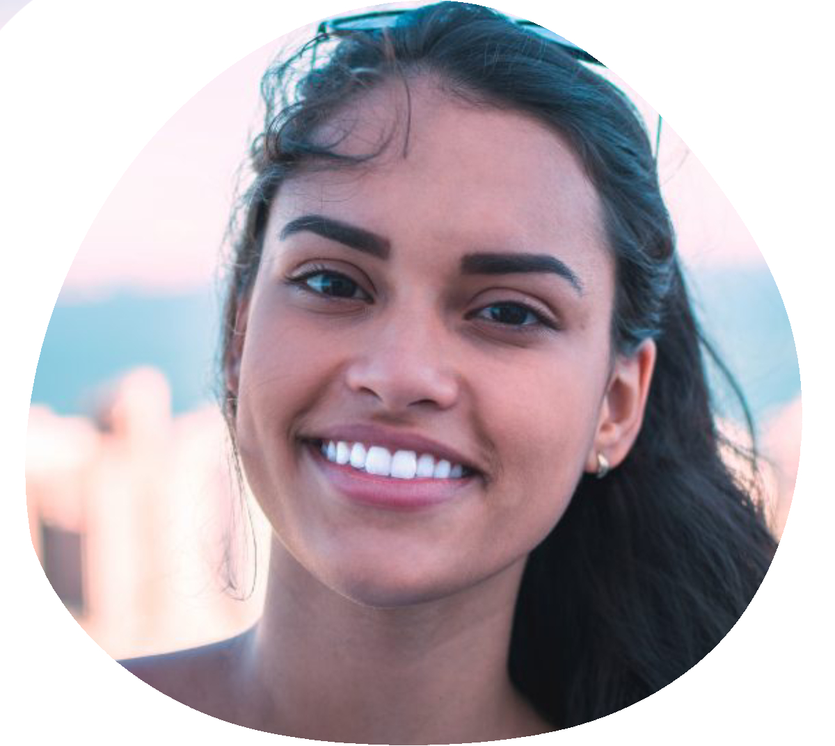 Dental Extraction https://oshawadentists.ca/wp-content/uploads/2024/10/Dental-Extraction.jpg