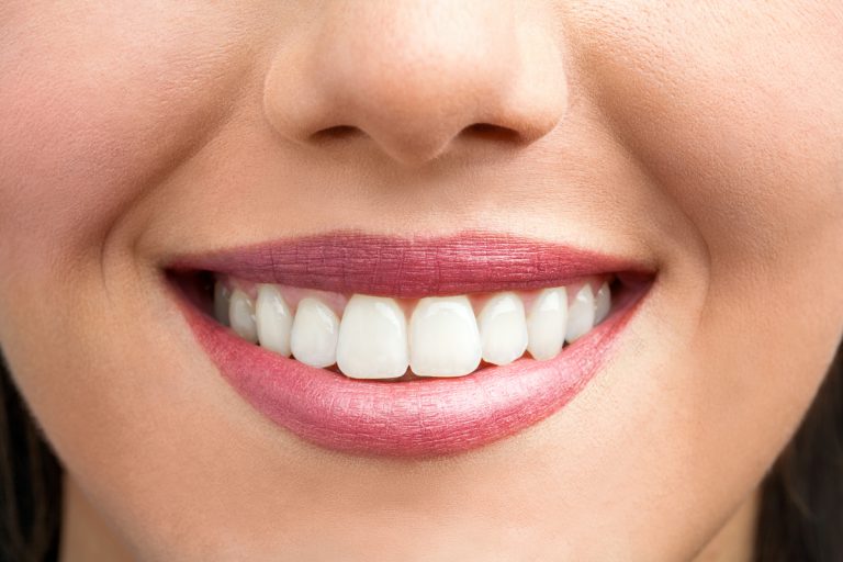 TeethWhitening_slide1-768 https://oshawadentists.ca/wp-content/uploads/2024/10/TeethWhitening_slide1-768.jpg