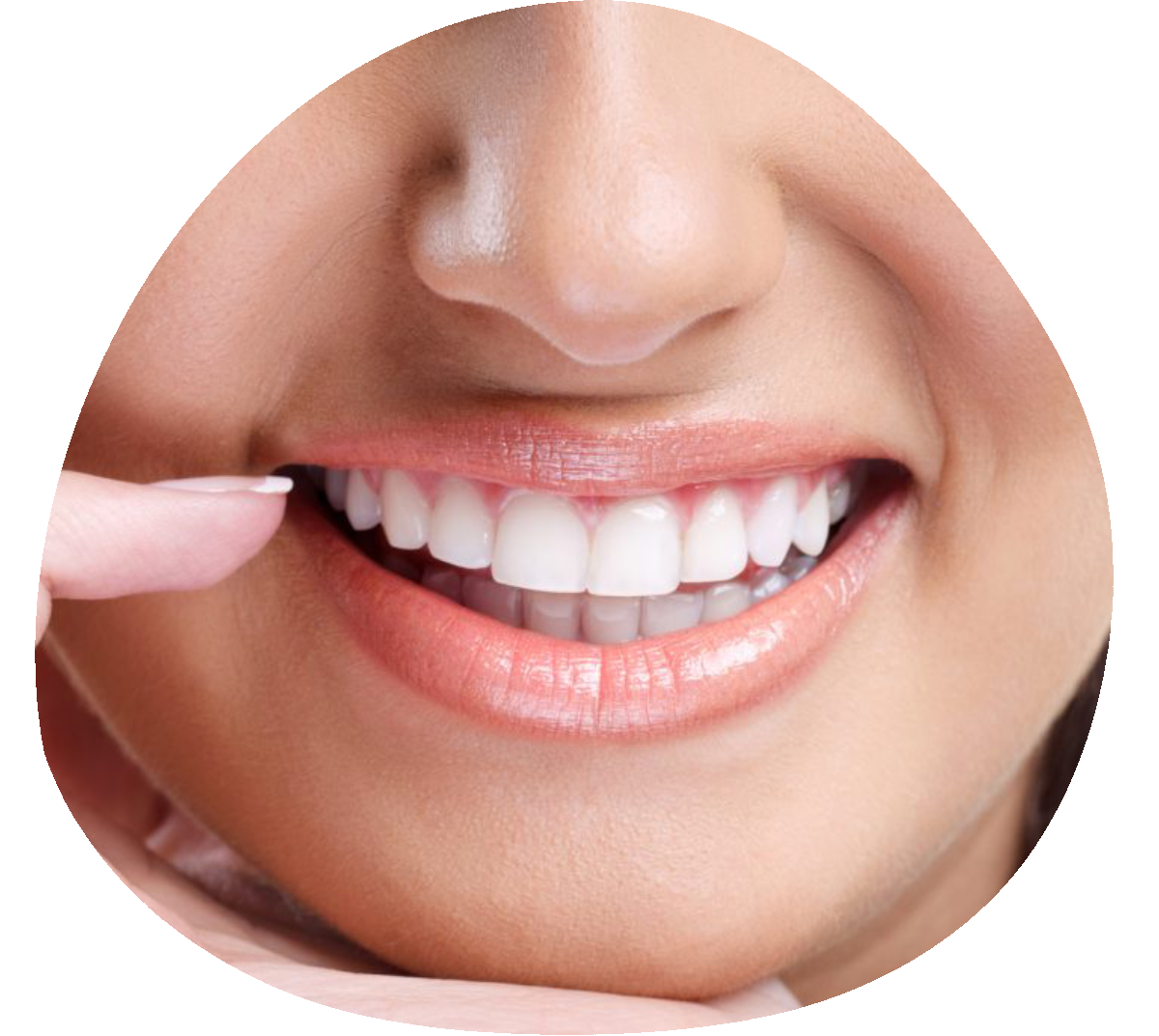 teeth whitening https://oshawadentists.ca/wp-content/uploads/2024/10/teeth-whitening.jpg